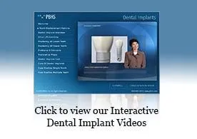 Interactive dental implant video launch button for patient education