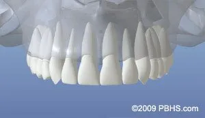 dentalimplant 01 - Periodontist Philadelphia | Laudenbach Periodontics & Dental Implants
