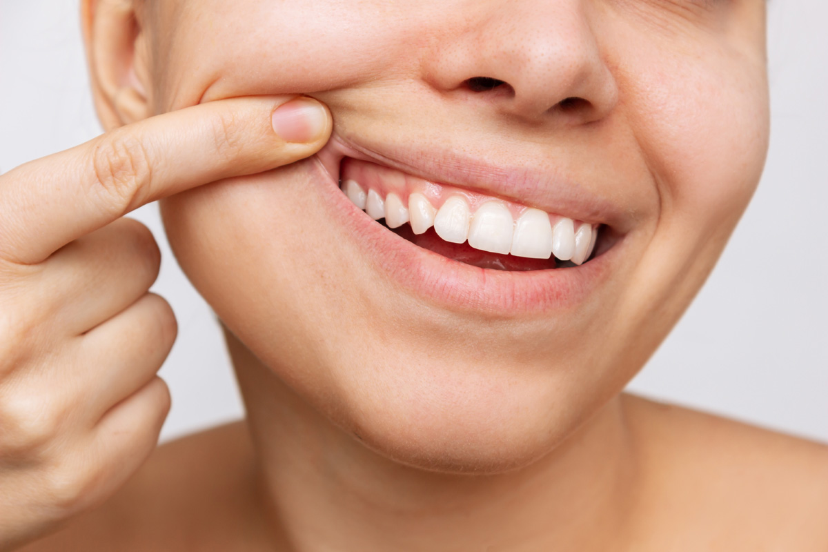Gum health