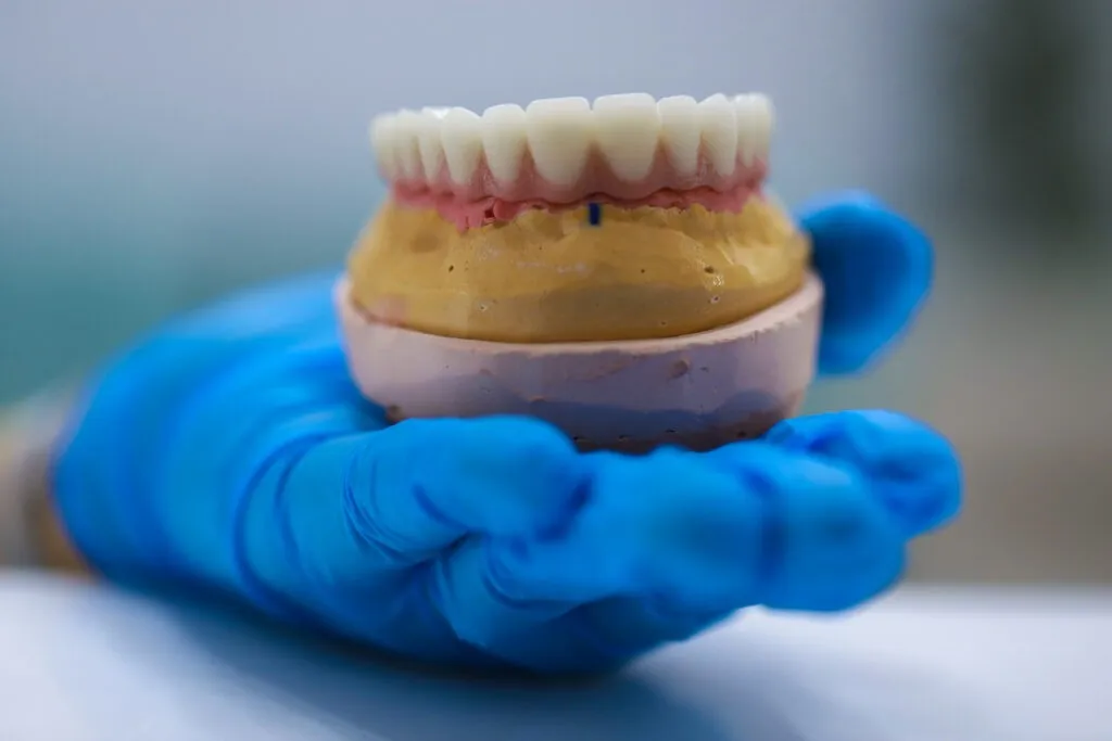 Full-arch porcelain implant-supported dental prosthesis for edentulous jaws with All-on-X and All-on-4 treatment procedure using dental implant surgery.