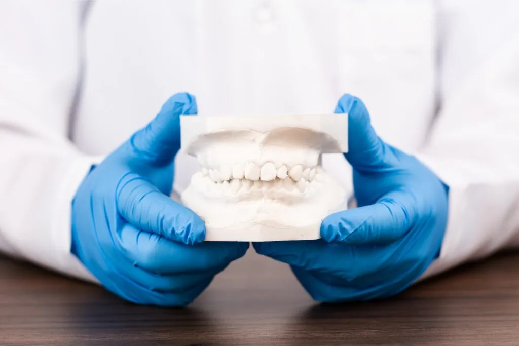 Orthodontic treatment planning with dental plaster model, dentist analyzing upper and lower jaw malocclusion, modern clinical dentistry concept.