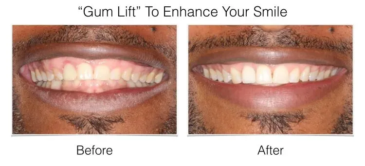 img2 - Periodontist Philadelphia | Laudenbach Periodontics & Dental Implants